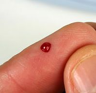 Кровь на пальце